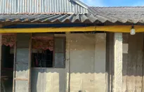 Nhịp thở khó khăn của bệnh nhi 4 tuổi mắc bệnh tim bẩm sinh