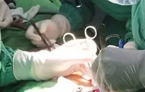 Cứ ngỡ trào ngược dạ dày, hóa ra u tuyến ức chèn ép trong lồng ngực