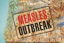 Washington declares emergency for measles outbreak