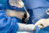 Breast Augmentation Complications: Capsular Contracture, Implant Rupture, Infection