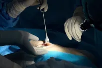 Breast firmness after augmentation: Signs, causes, and treatment