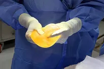 A rare case of bilateral breast implants with different implant types