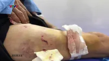 Alo Doctor - 06/5/2025