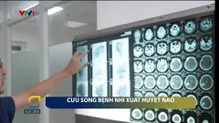 Cứu sống bệnh nhi xuất huyết não