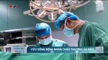 Cứu sống bệnh nhân chấn thương sọ não