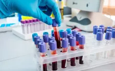 Hơn 40% người Việt có cholesterol máu cao