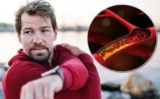 6 thói quen cần thay đổi để kiểm soát cholesterol