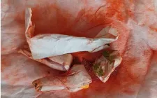 Ngộ độc chì sau khi bôi và uống "thuốc cam" 7 ngày