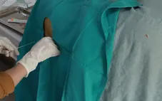 Viêm màng não: Nhận biết sớm để tránh biến chứng nguy hiểm