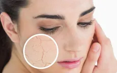 Tuyệt chiêu giúp làn da đẹp trong mùa đông
