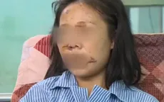 Lạnh người vụ bạo hành cắt gân tay, chân qua lời kể người vợ