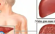 Khó tránh khỏi nhiễm bệnh viêm gan C khi xăm hình