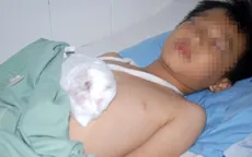 Lâm Đồng: Nổ sạc đèn pin, bé 8 tuổi dập nát bàn tay