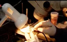Dùng tia laser chữa lành vết thương