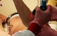 'Em bé napalm’ Kim Phúc được điều trị vết thương chiến tranh