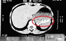 Trân châu trong trà sữa Trung Quốc chứa thành phần đáng ngờ