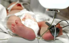Dấu hiệu viêm màng não mô cầu