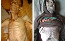 Madaya trở thành "địa ngục trần gian" trong cuộc chiến vây hãm tại Syria