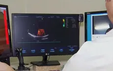 Robot cho phép bác sỹ siêu âm từ xa cho bệnh nhân