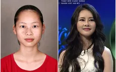 Change Life - Thay đổi cuộc sống: Cô sinh viên công nghệ thông tin lột xác nhờ xóa vết chàm