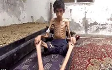 Mỹ lên tiếng về khủng hoảng nhân đạo tại Madaya