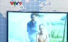 Đình chỉ một cơ sở trị bệnh không phép tại An Giang