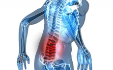 Điều trị hiệu quả chứng đau lưng bằng y học cổ truyền