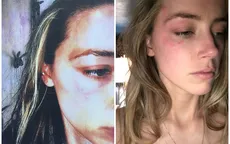 Johnny Depp dùng điện thoại đánh bầm mặt vợ