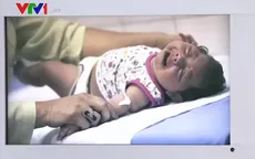 Colombia xác nhận 2 trẻ sơ sinh mắc chứng đầu nhỏ do virus Zika