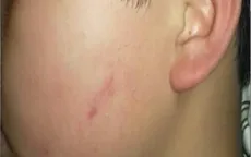 Hà Nội: Đình chỉ dạy học cô giáo cho hơn 40 học sinh tát bạn trong lớp