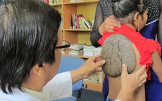 Em bé “mai rùa” xuất viện khỏe mạnh