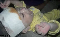 Em bé được cứu sống ở Idlib, Syria - Bi kịch cuộc chiến