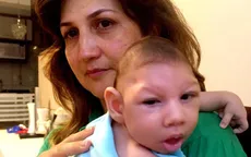 Virus Zika gây dị tật qua đường nhau thai
