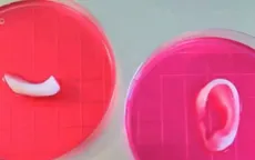 Công nghệ 3D in xương sụn nhân tạo