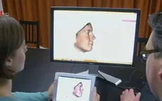 Công nghệ 3D giúp phẫu thuật mũi chính xác hơn