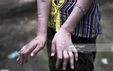 Vấn nạn bạo hành trẻ em tại Myanmar