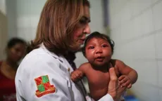 Nghi vấn chứng teo não ở trẻ không do muỗi truyền virus Zika