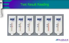 Tự xét nghiệm HIV bằng que thử sao cho đúng?