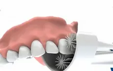 Glaresmile – Bàn chải làm sạch răng trong 10 giây