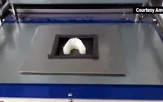 Tự chế niềng răng bằng máy in 3D
