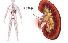 Phòng ngừa suy giảm chức năng thận
