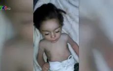 Địa ngục trần gian Madaya - nơi nan đói hoành hành