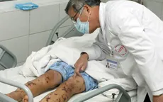 Hà Nội ghi nhận ca viêm não mô cầu đầu tiên năm 2016