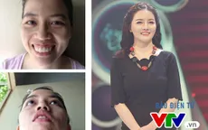 Change Life: Cô gái răng hô bị gia đình bạn trai chối từ "biến hình" thành búp bê