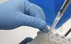 WHO lo ngại không điều chế kịp vaccine Zika