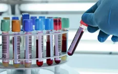 Ứng dụng kỹ thuật phân tử trong xét nghiệm máu sàng lọc virus