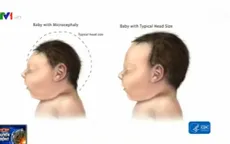 Virus Zika có thể lan tới Pháp