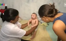 Liệu pháp xoa bóp điều trị trẻ em bị dị tật đầu nhỏ do Zika