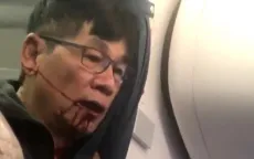 United Airlines “trắng án” sau vụ bạo lực hành khách