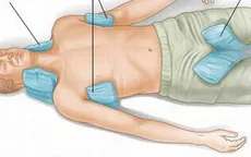 Phòng tránh sốc nhiệt khi lao động trong thời tiết nắng nóng